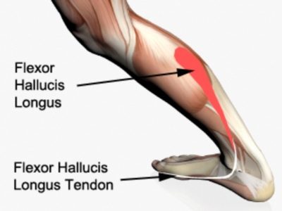 Flexor hallucis longus tendonitis anatomy