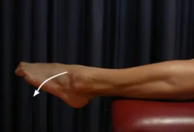Plantarflexion for a Dislocated Ankle