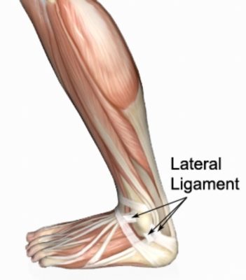 Relevant Anatomy of a Sprained Ankle 