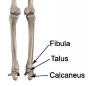 Relevant Bony Anatomy for a Sprained Ankle