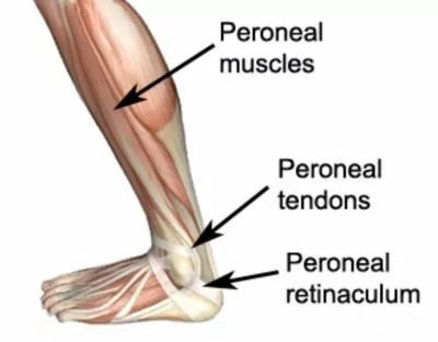 peroneal retinaculum