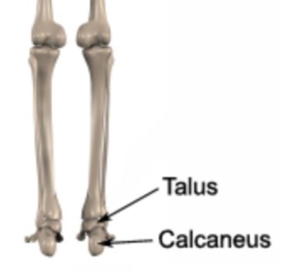 Relevant Bony Anatomy for Sinus Tarsi Syndrome - Talus and Calcaneus