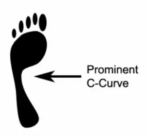 Choosing a Shoe - Supinated Foot Print