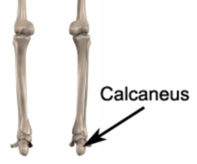 Calcaneal Stress Fracture Anatomy