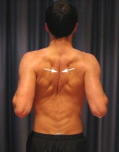 Upper Back Stretches - Shoulder blade Squeezes