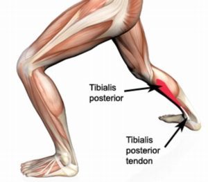 Tibialis Posterior Tendon Anatomy