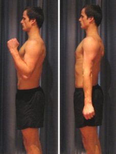 Exercises for Olecranon Bursitits - Elbow Bend to Straighten