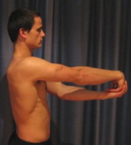 Exercises for Ulnar Nerve Compression - Wrist & Finger Extensor Stretch