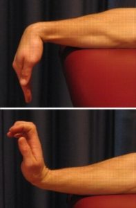 Exercise for a Radius Fracture - Wrist Bends