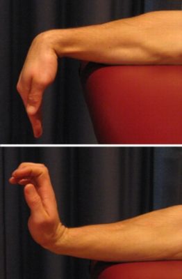 Exercises for a Scapula Fracture - Wrist Flexion to Extension