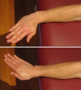 Exercises for a Wrist Sprain - Wrist Side Bends