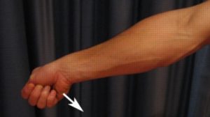 Exercises for De Quervains Tendonitis - EPL stretch