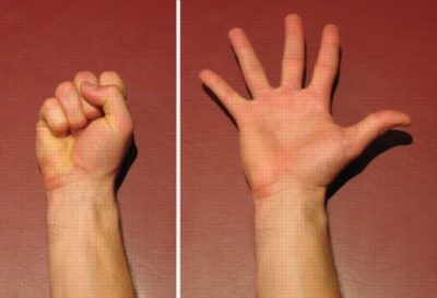 Exercises for a Scapula Fracture - Hand Open to Close