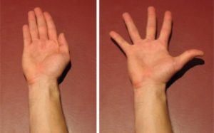 Exercise for a Dislocated Finger - Finger Adduction to Abduction