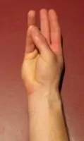 Exercises for a Sprained Thumb - Thumb Opposition