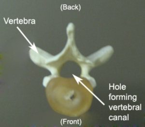 Vertebral Anatomy for Spinal Canal Stenosis