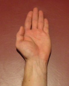 Hand Strengthening Exercises -Finger Adduction