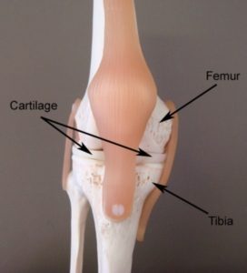 Knee Arthritis Anatomy