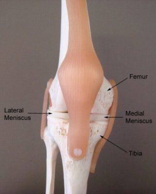 Relevant Anatomy for a Medial Meniscus Tear