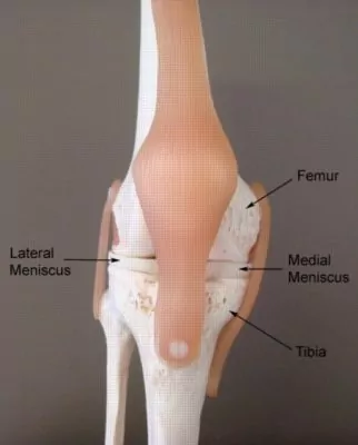 Medial deals meniscus pain