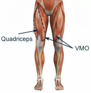 Quadriceps and VMO anatomy