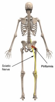 Piriformis Cushion - Piriformis Pain