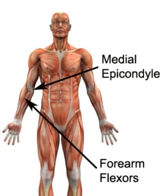 Golfers Elbow Anatomy (Medial Epicondyle)