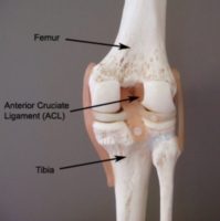 Knee Pain - ACL Tear (Anatomy)