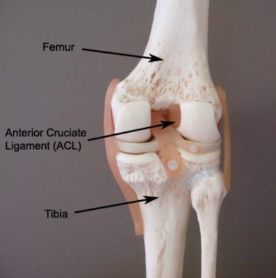 ACL Tear (Anatomy)