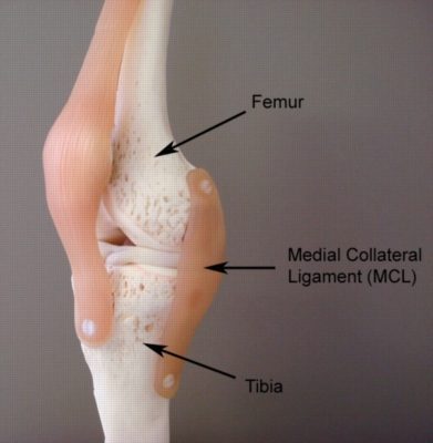 Anatomy of a MCL Tear and medial collateral ligament