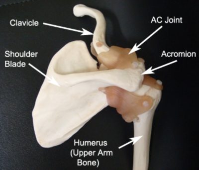 AC Joint Sprain - Shoulder Separation - AC Injury - PhysioAdvisor