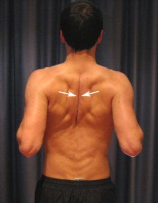 channel so much water Upper Back Stretches - Upper Back Flexibility Exercises - PhysioAdvisor