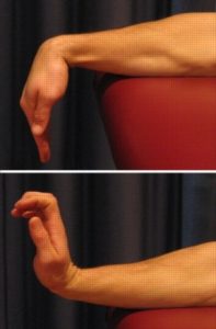 Exercises for Wrist Tendonitis - Wrist Bends