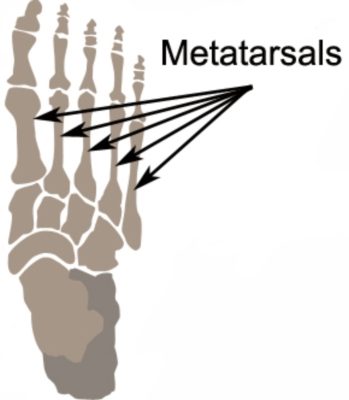 Anatomy of a metatarsal stress fracture