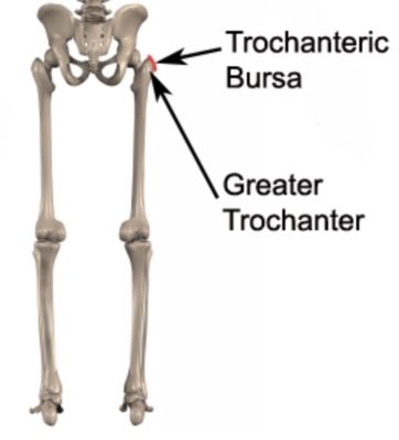 Anatomy of Trochanteric Bursitis