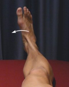 Inversion of the Ankle