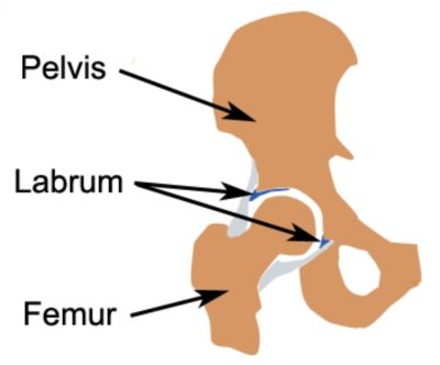 Anatomy of femoroacetabular impingement