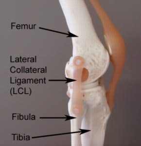 Anatomy of a LCL tear and lateral collateral ligament