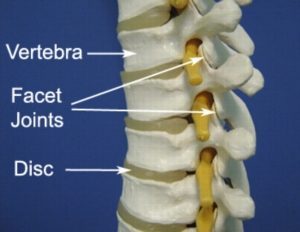 Thoracic Facet Joint Sprain Anatomy