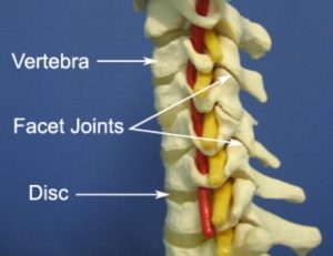 Anatomy of a Facet Joint Sprain of the Neck
