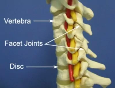 Anatomy of wry neck