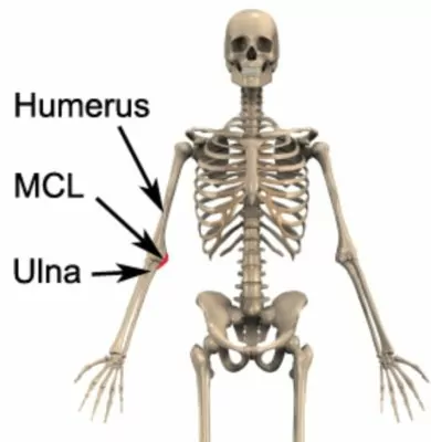 MCL Sprain Rehab Program, Early, Mid-, & Late Stage