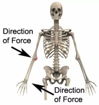 Medial collateral ligament injury elbow