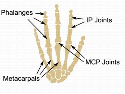Sprained Finger Anatomy