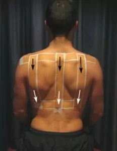 Postural Taping Vertical Lines