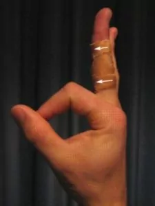 Taping for Finger Injuries — Grassroots Physical Therapy