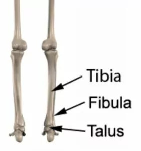 medial malleolus of tibia