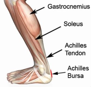 Achilles Bursitis Anatomy