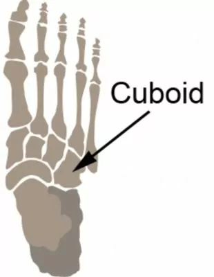 Relevant Anatomy for a Cuboid Stress Fracture