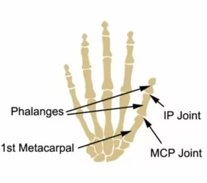 Relevant Anatomy for a Sprained Thumb